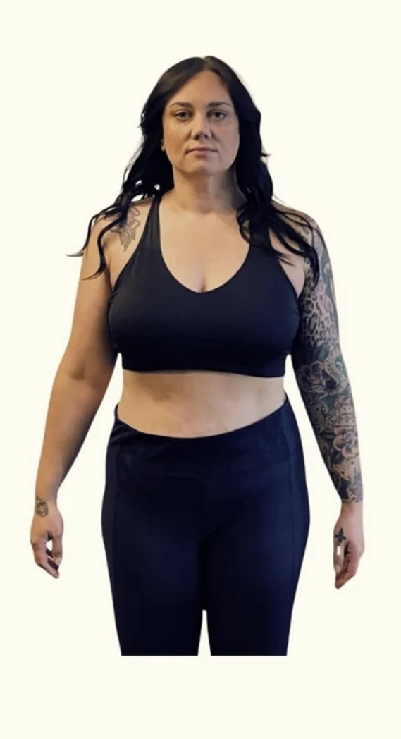 Before medical weight loss at Push Med in Greenville SC
